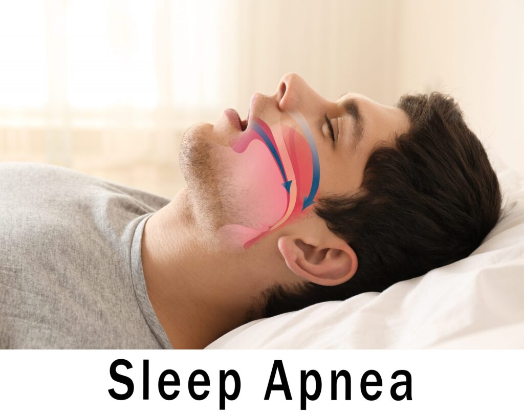 How to Take Control of Your Sleep Apnea in 2021