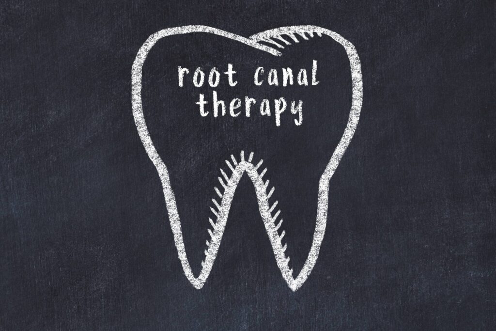 what is a root canal