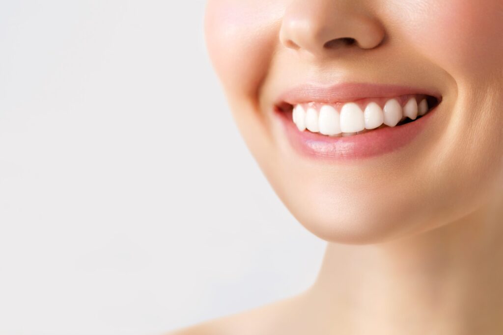 What To Know About Professional Teeth Whitening