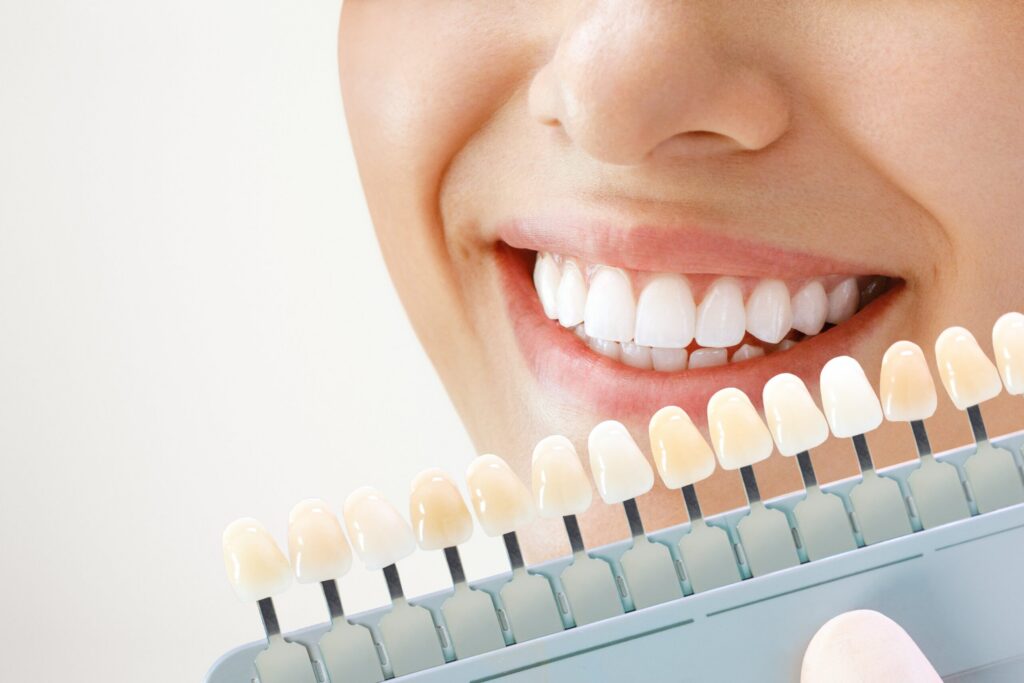 Is Teeth Whitening Bad for Your Teeth? Let’s Address the Myths